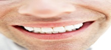 implantes-dentales-medellin               